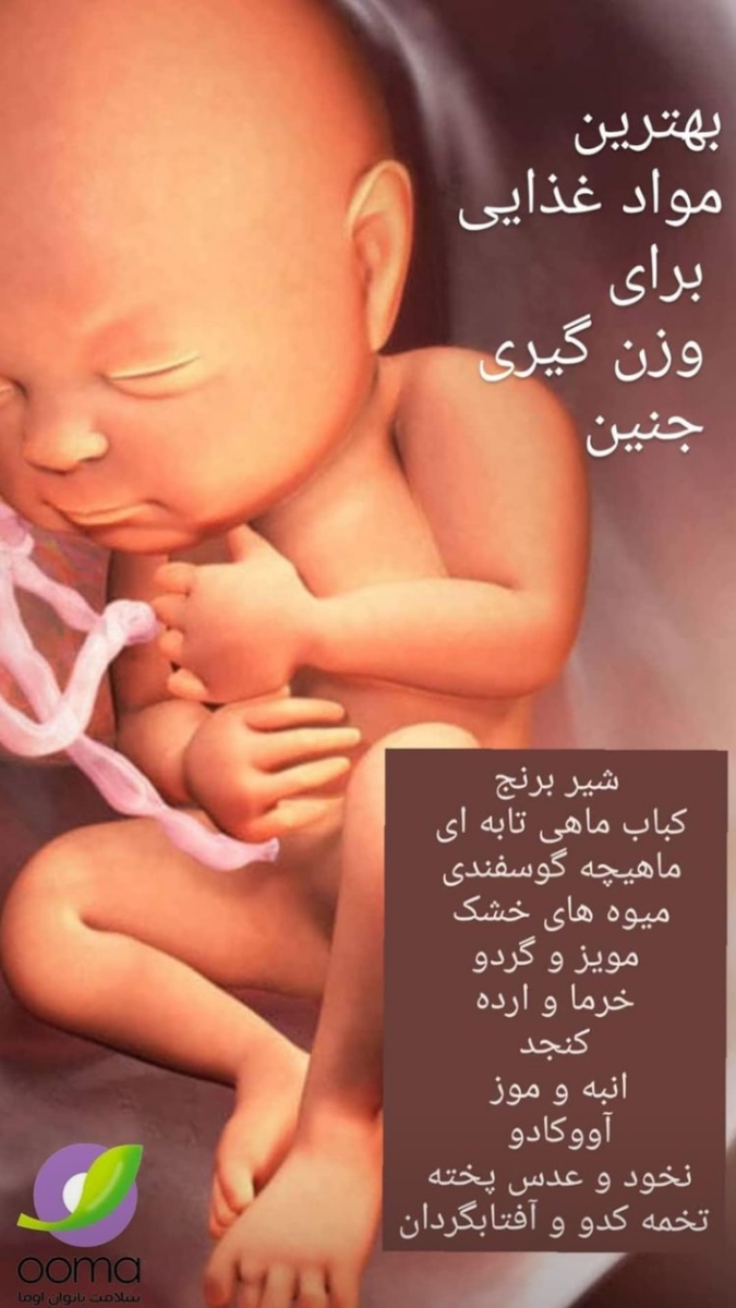 سونو تعیین وضعیت من به چه صورت هستش؟