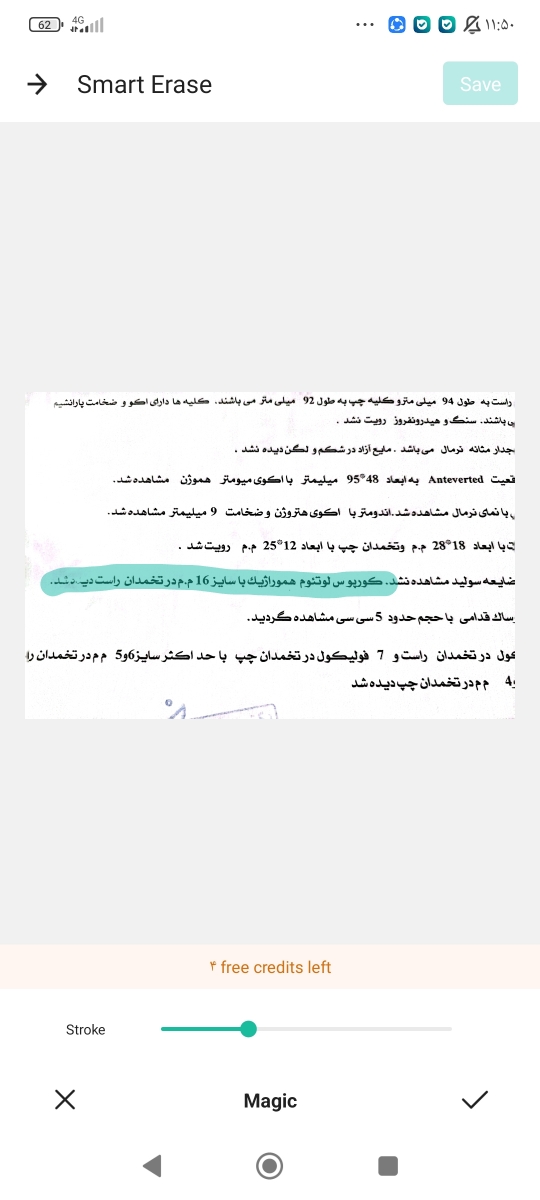 کورپوس لوتئوم هموراژیک یعنی چی؟؟