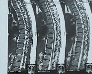 نامه از دکتر جراح برای سزارین و نوع بیهوشی