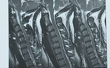 نامه از دکتر جراح برای سزارین و نوع بیهوشی