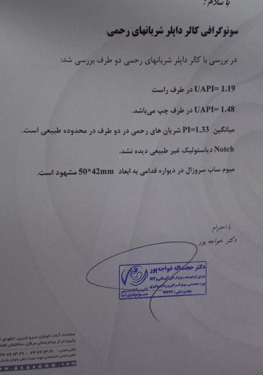 انقباض سمت راست شکم