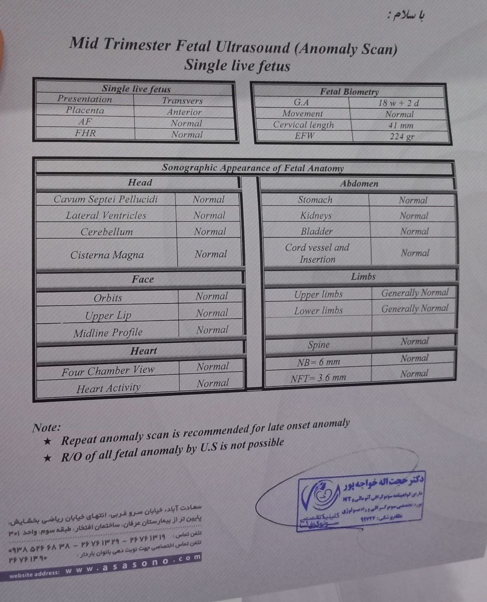 انقباض سمت راست شکم