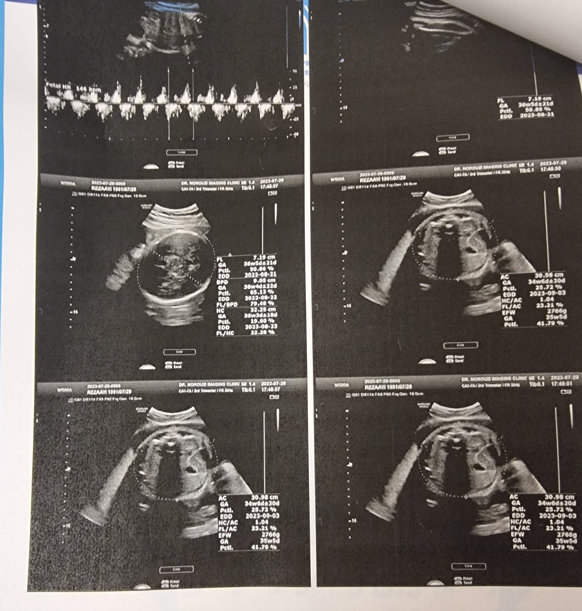 وزن بچه درهفته ۳۶ و ۴ روز