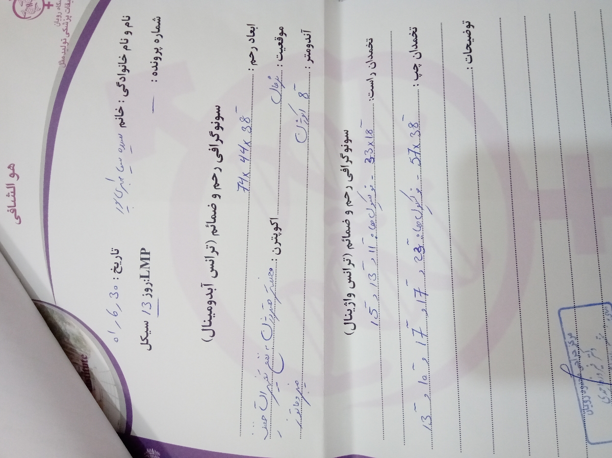 رفع تنبلی تخمدان وضعف اسپرم همسر