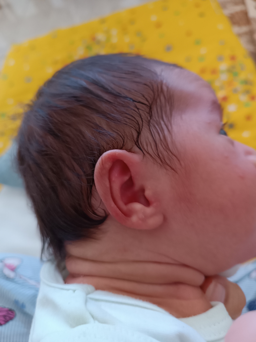 جوش قرمز روی صورت نوزاد و سوزش و خارش واژن مادر جوش قرمز روی صورت نوزاد و سوزش و خارش واژن مادر
