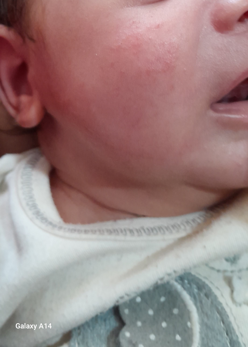 س دکترعزیزدونه ایاحساسیته ازسفکسیمه