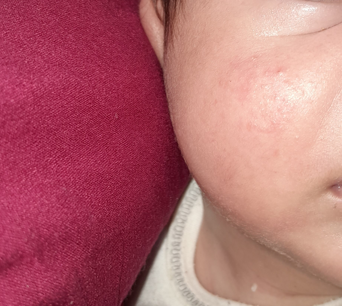 س دکترعزیزدونه ایاحساسیته ازسفکسیمه