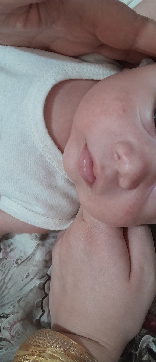 س دکترعزیزدونه ایاحساسیته ازسفکسیمه