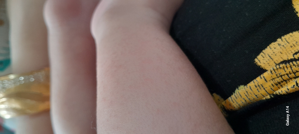 س دکترعزیزدونه ایاحساسیته ازسفکسیمه