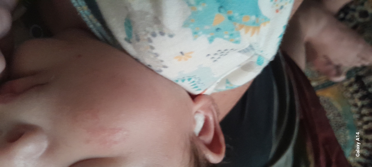 س دکترعزیزدونه ایاحساسیته ازسفکسیمه