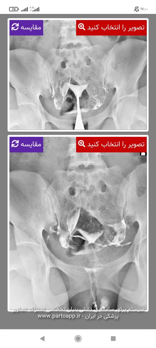 تفسیر جواب عکس رنگی