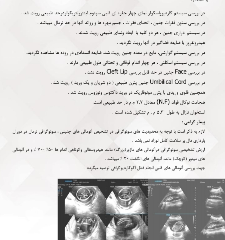 رفتم سونو انومالی، نگرانم میشه راهنماییم کنید