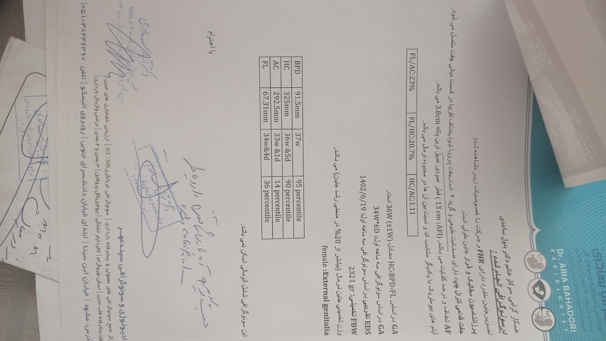 وضعیت جفت در هفته 36