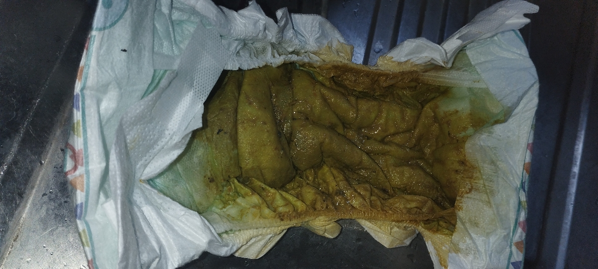 دلیل اسهال نوزاد 7ماهه