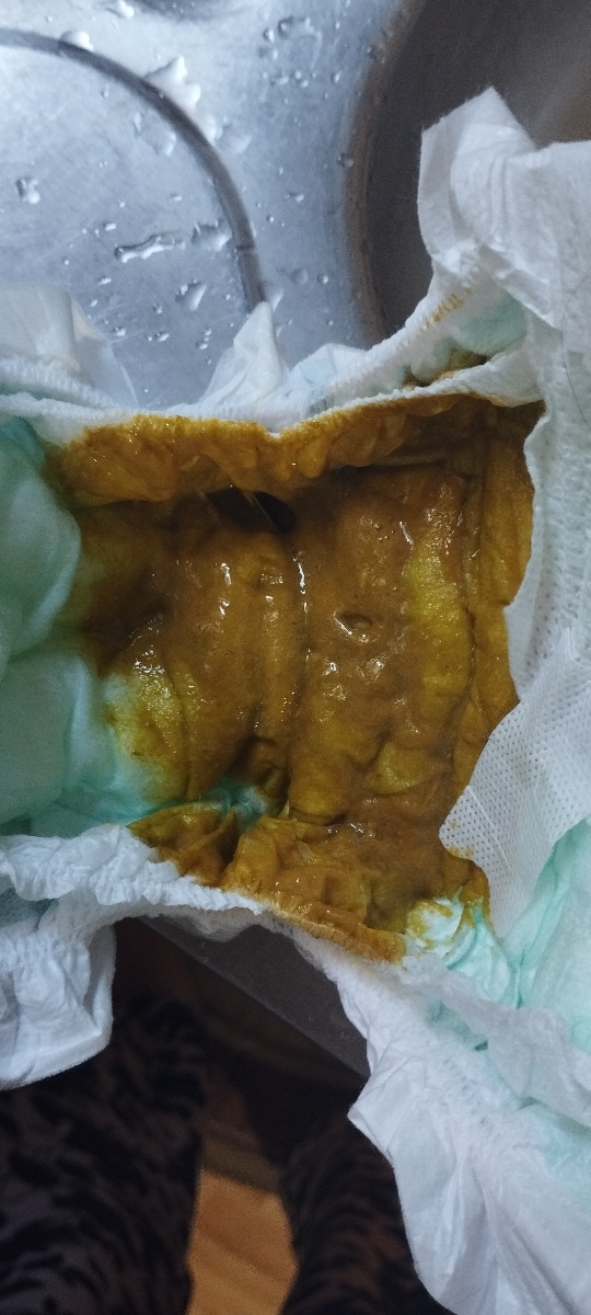 دلیل اسهال نوزاد 7ماهه