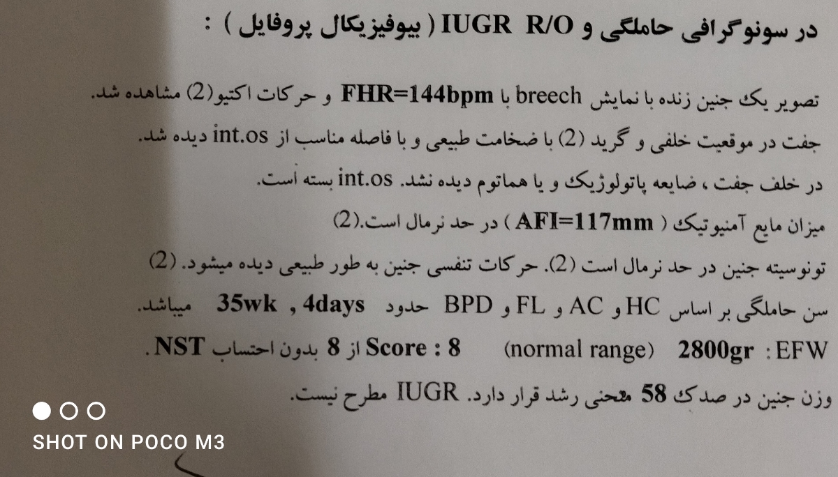 سونو من رو تشریح کنید