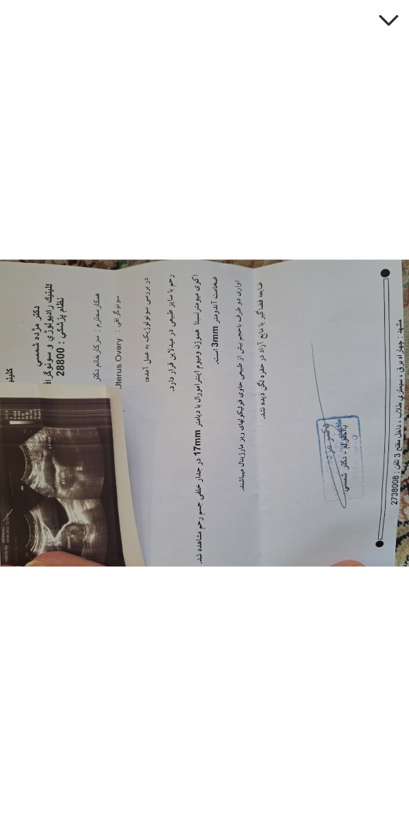 پریود شدن بعد دوهفته پریود شدن بعد دوهفته