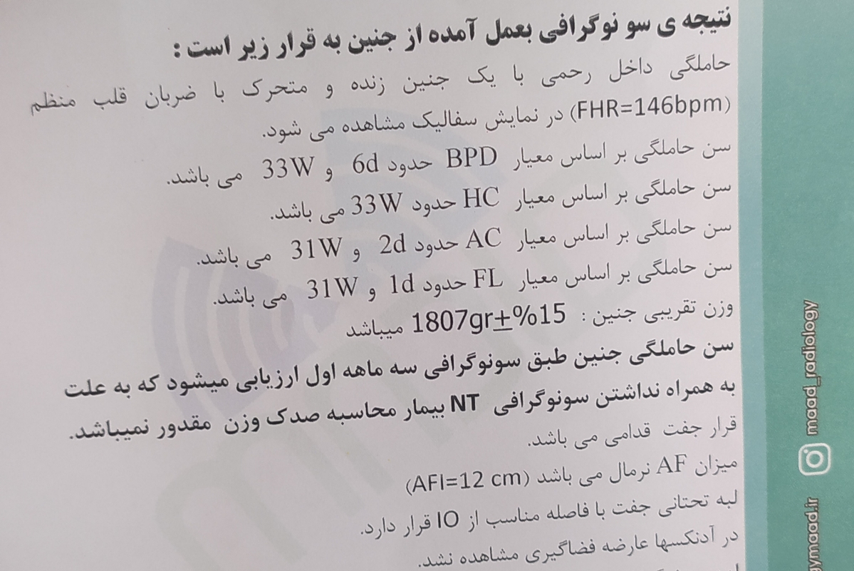 سونوی رشد جنین سونوی رشد جنین