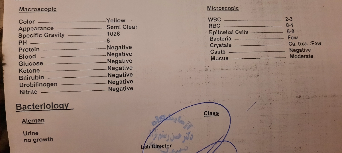 سوزش ادرار و تفسیر ازمایش