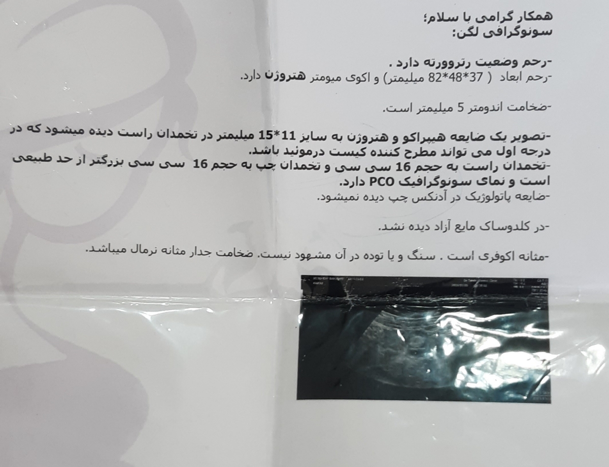 کیست درموئید توی سونوگرافی