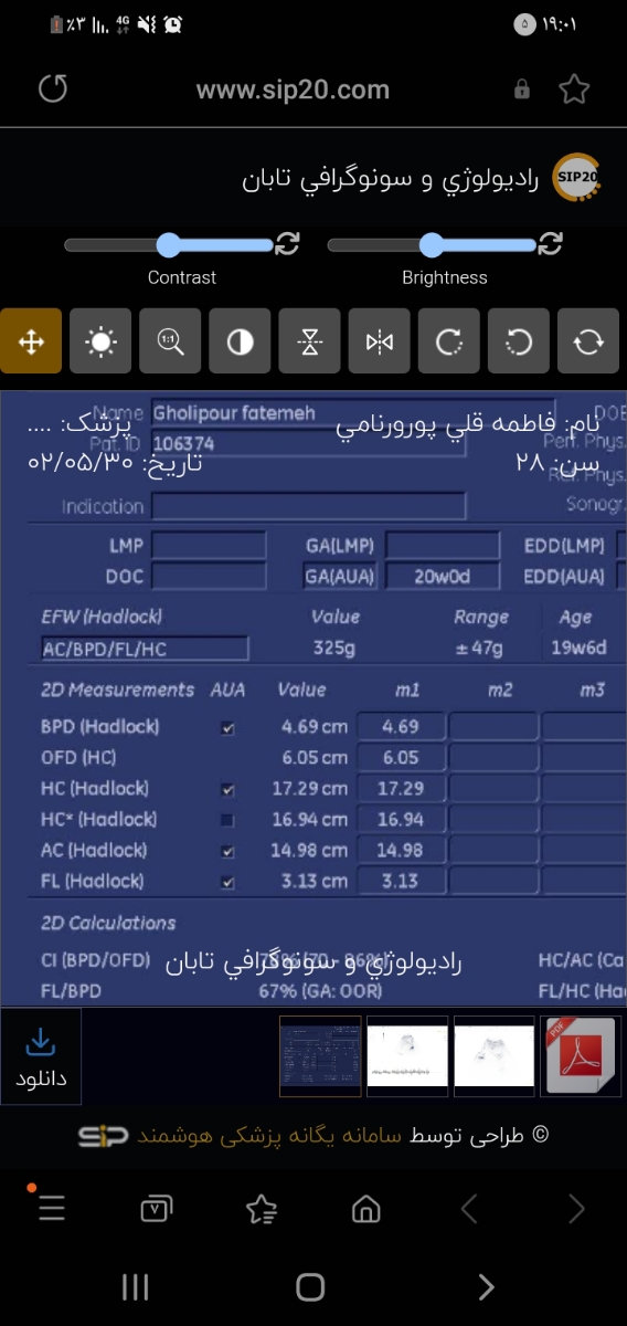 لکه بینی در هفته ۲۰ لکه بینی در هفته ۲۰