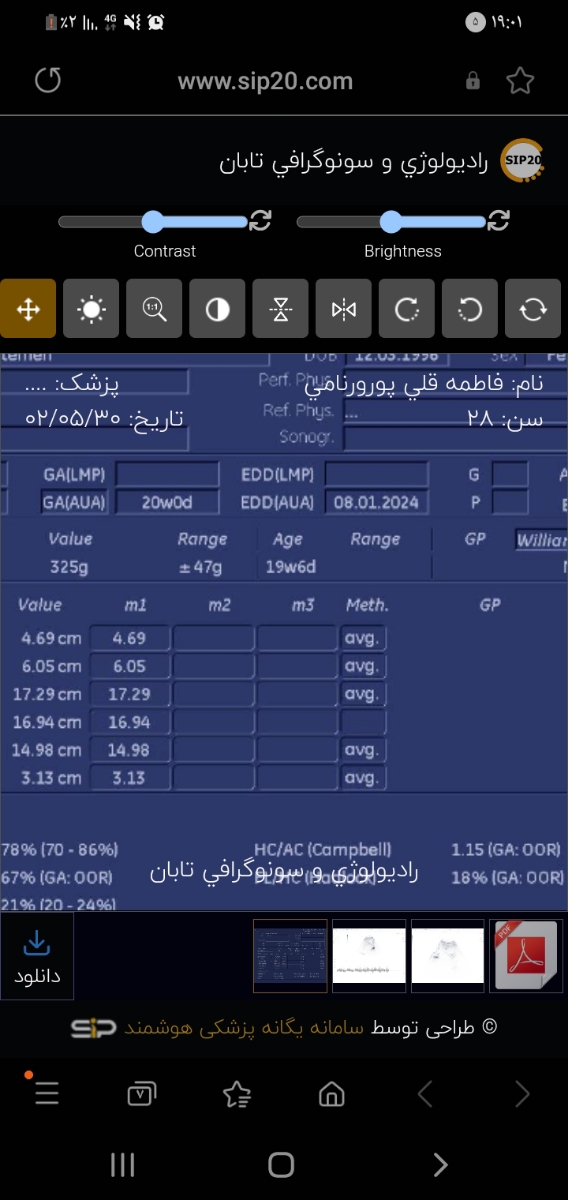 لکه بینی در هفته ۲۰ لکه بینی در هفته ۲۰