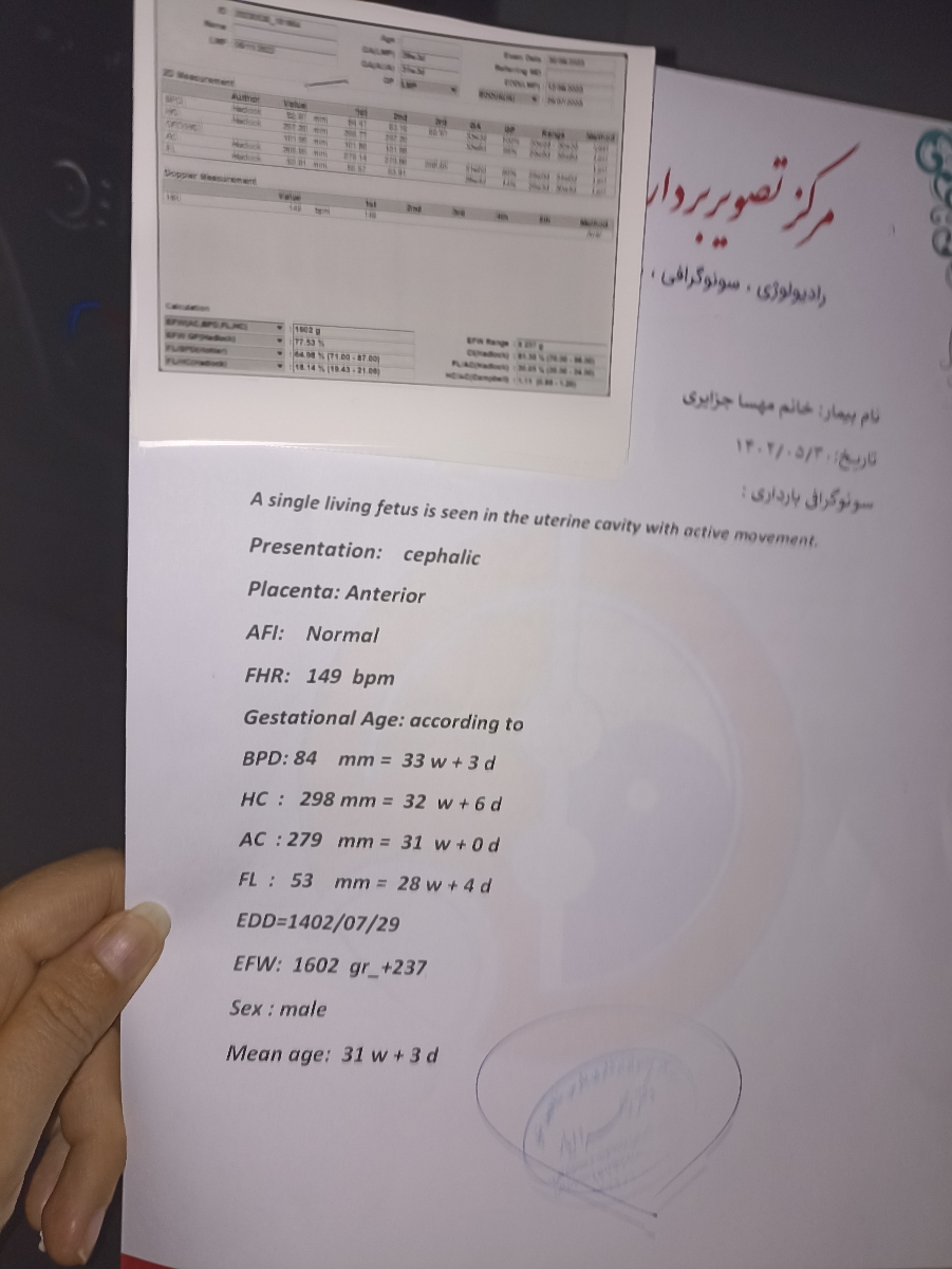 خانم دکتر تفسیر سونو ۳۰هفتگی
