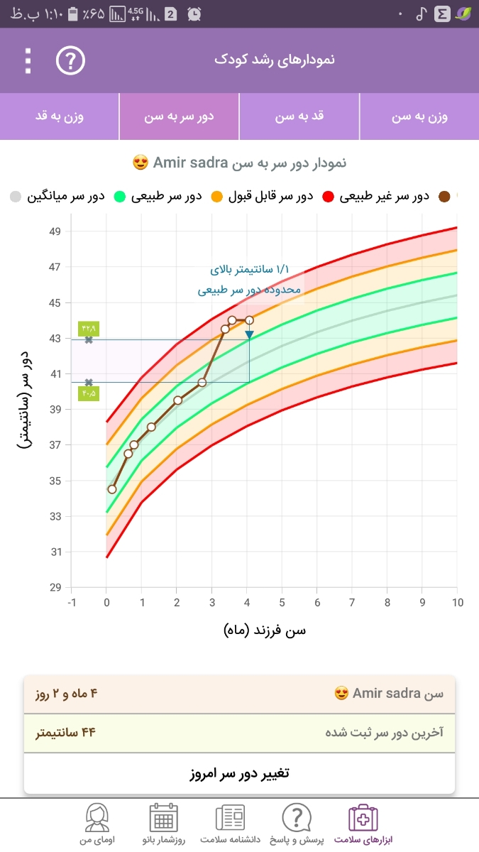 اندازه دور سر نوزاد