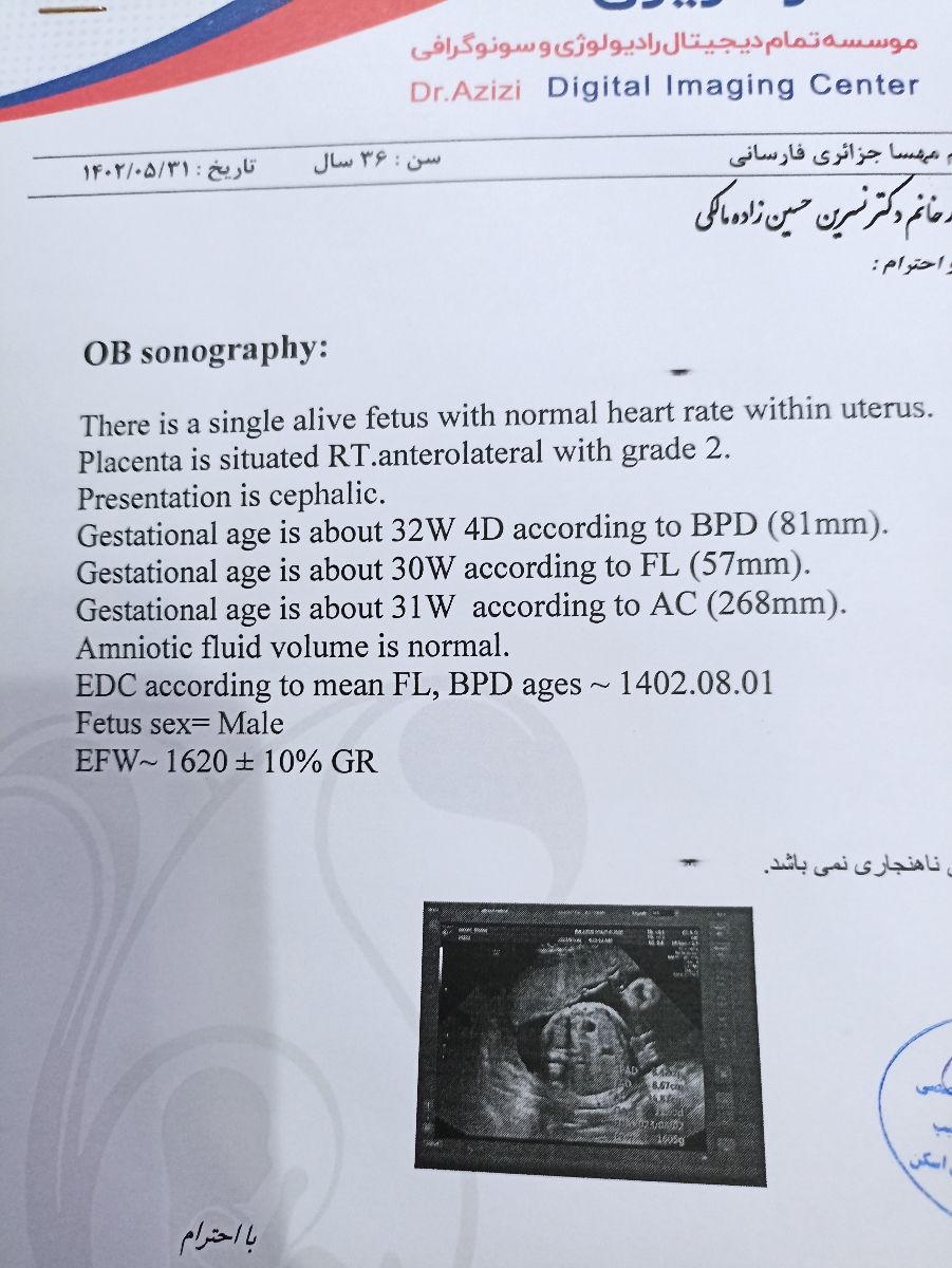 خانم دکتر تفسیر سونو ۳۰هفتگی
