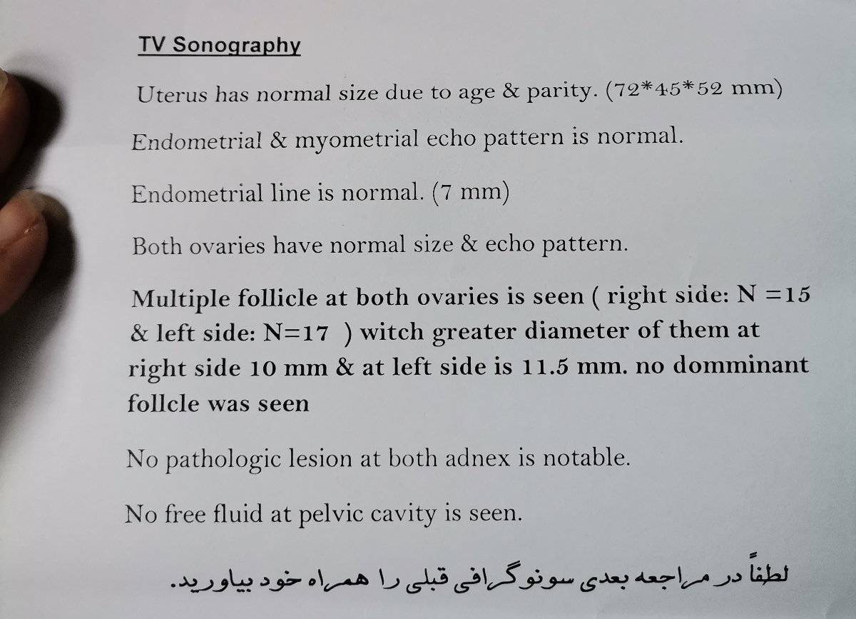 تنبلی تخمدان شدید