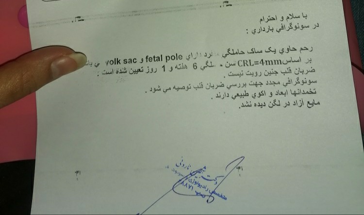 توقف ضربان قلب جنین و انجام سنوگرافی توقف ضربان قلب جنین و انجام سنوگرافی