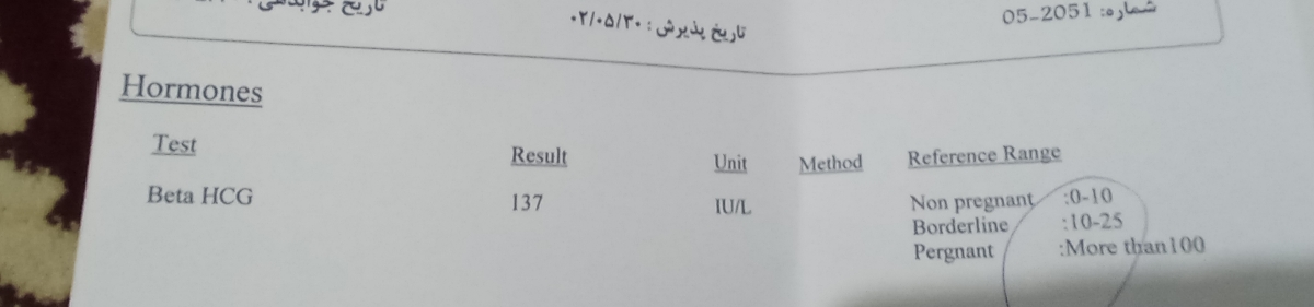 توقف ضربان قلب جنین و انجام سنوگرافی توقف ضربان قلب جنین و انجام سنوگرافی