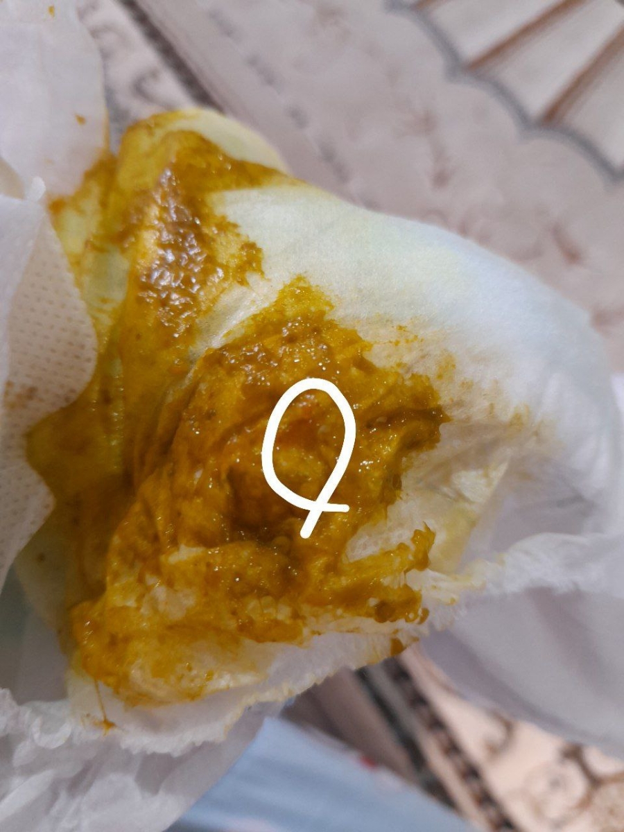 خوردن هندوانه در شیر دهی و قرمزی دفع نی نی
