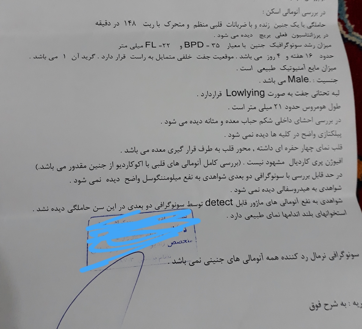 تفسیر سونو گرافی آنومالی