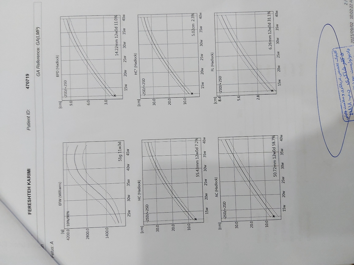 تفسیر جواب سونوی ان تی