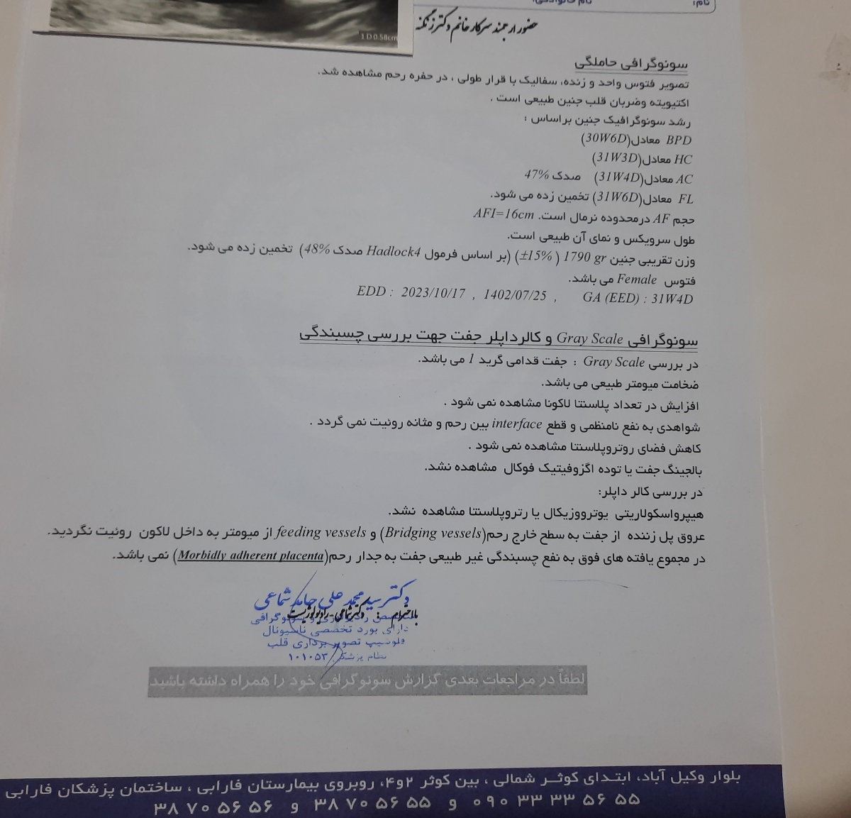 نحوه ی محاسبه ی تاریخ دقیق زایمان