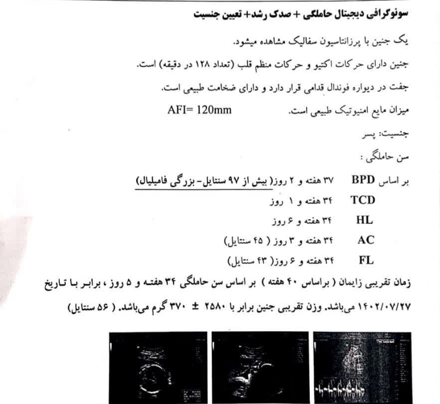 تفسیر سونوگرافی و اندازه سر جنین