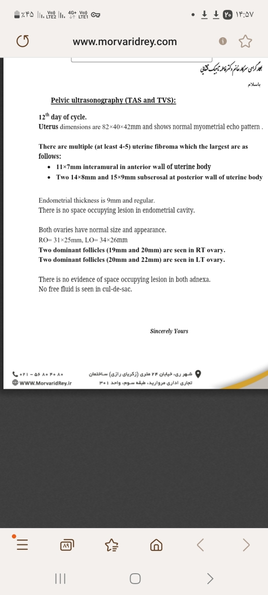 تفسیر سونوی فولیکول دوازدهم سیکل