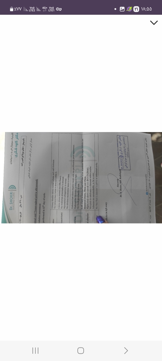 تفسیر سونوی فولیکول دوازده سیکل و تزریق آمپول hcg