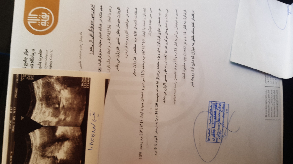 تفسیرسونودکترجان دوستان برای باروری
