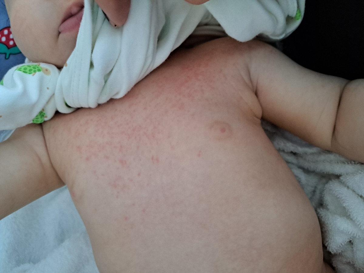 دادن شربت استامینفون به جای قطره