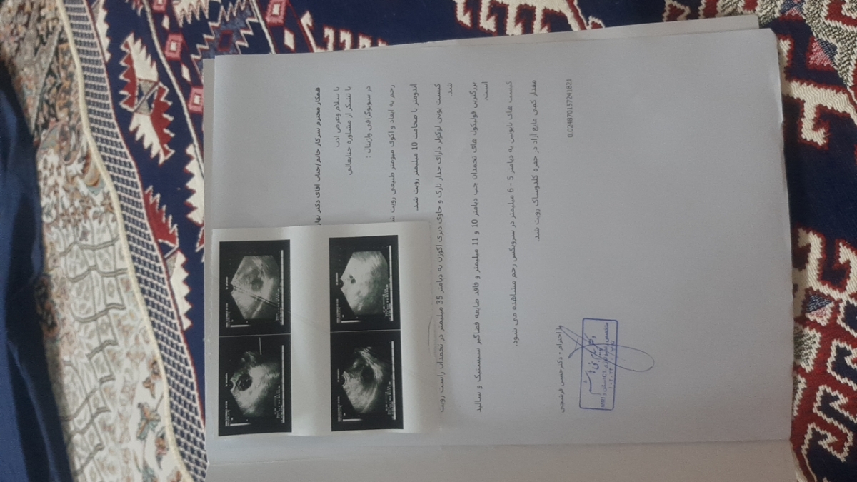 سونوواژینال ۱۴سیکل وکیست تخمدان
