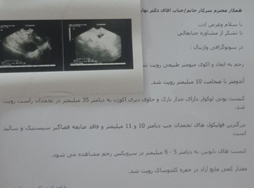 سونوواژینال ۱۴سیکل وکیست تخمدان