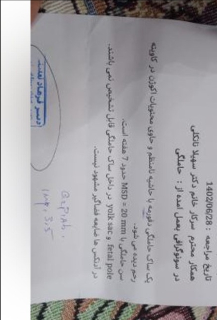 ساک بارداری دفرمه در هفته هفتم ساک بارداری دفرمه در هفته هفتم
