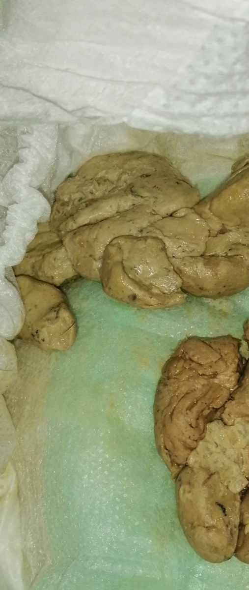 رنگ بی رنگ و سفید مدفوع کوددک