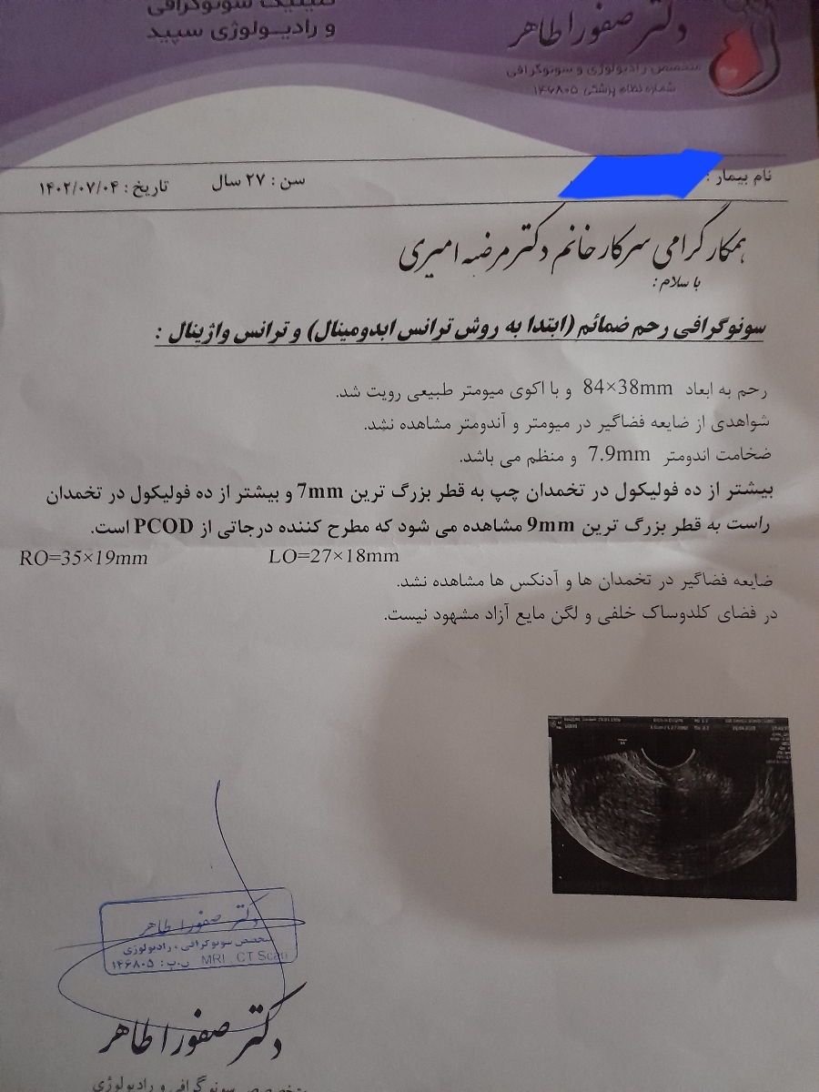 سونو فولیکل روز دهم