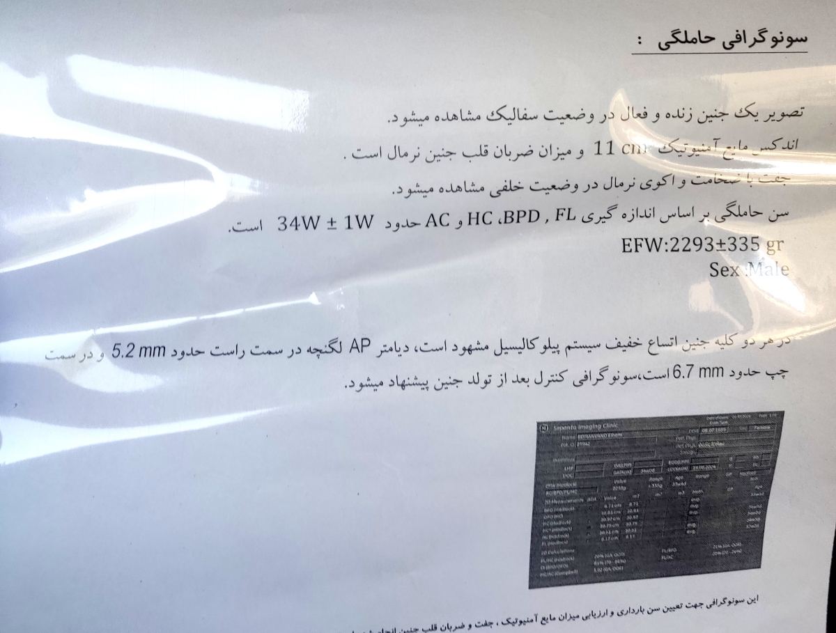 اتساع خفیف کلیه های جنین یعنی چی؟خطرناکه؟
