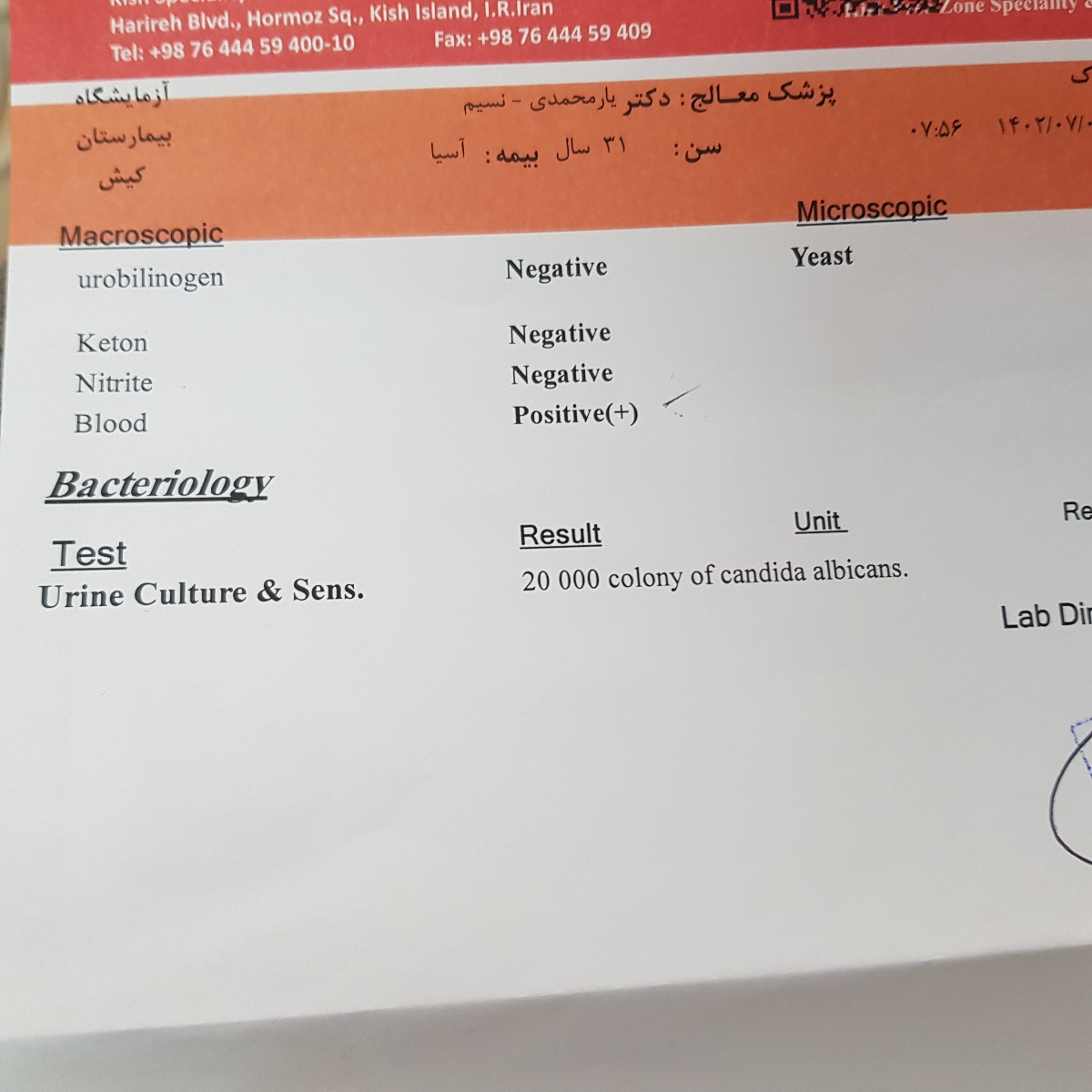 سلام خانم دکتر با عفونت قارچی چیکار کنم