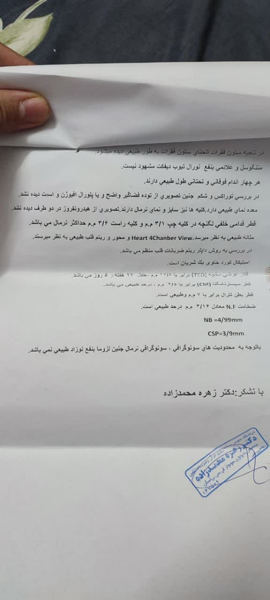 تفسیر سونو ۳۰ هفته تفسیر سونو ۳۰ هفته