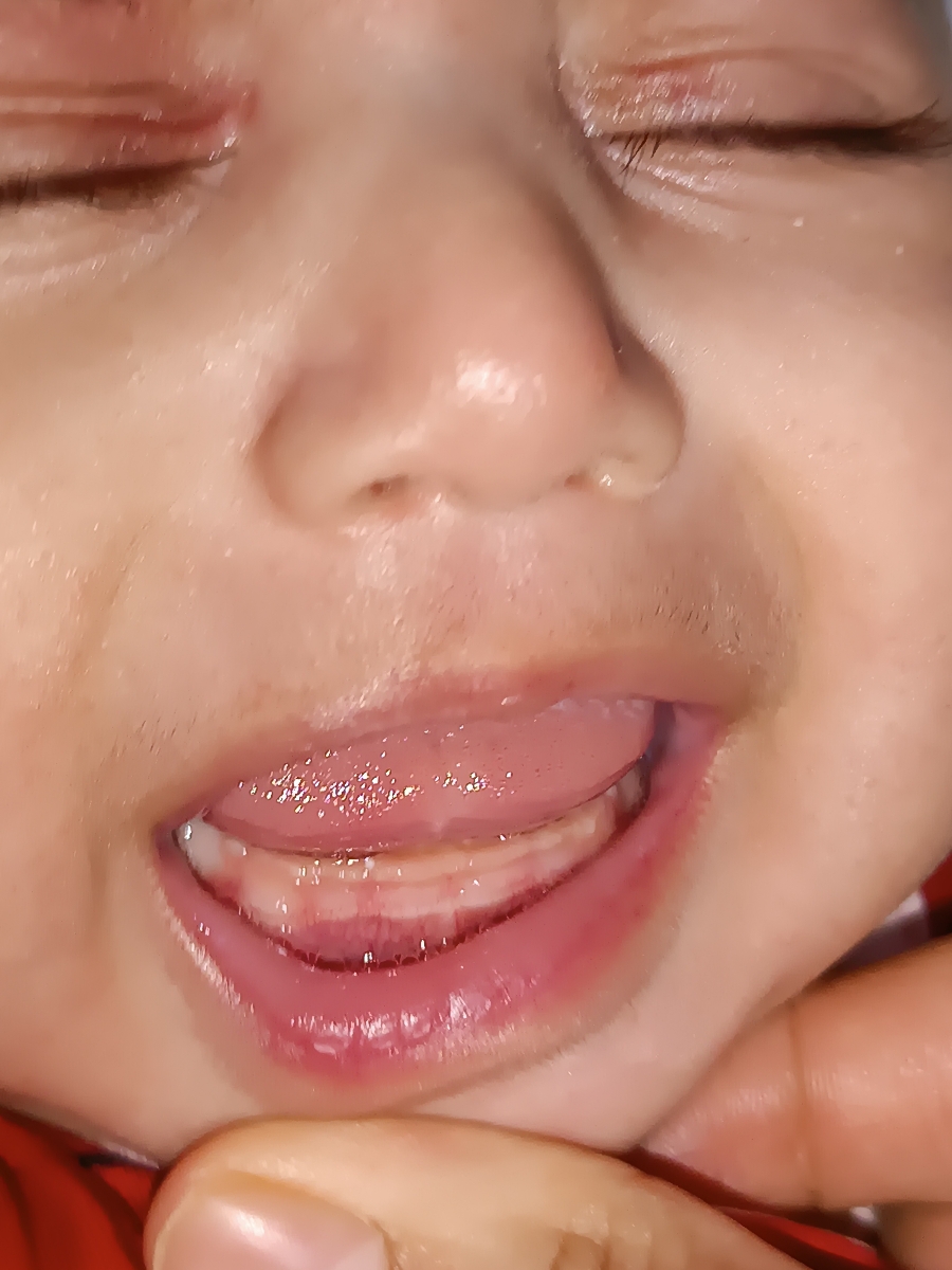 علت شیر نخورده نوزاد
